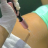 Intradermoterapia pressurizada